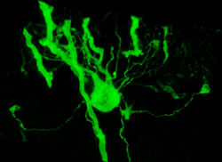 Multiphoton image