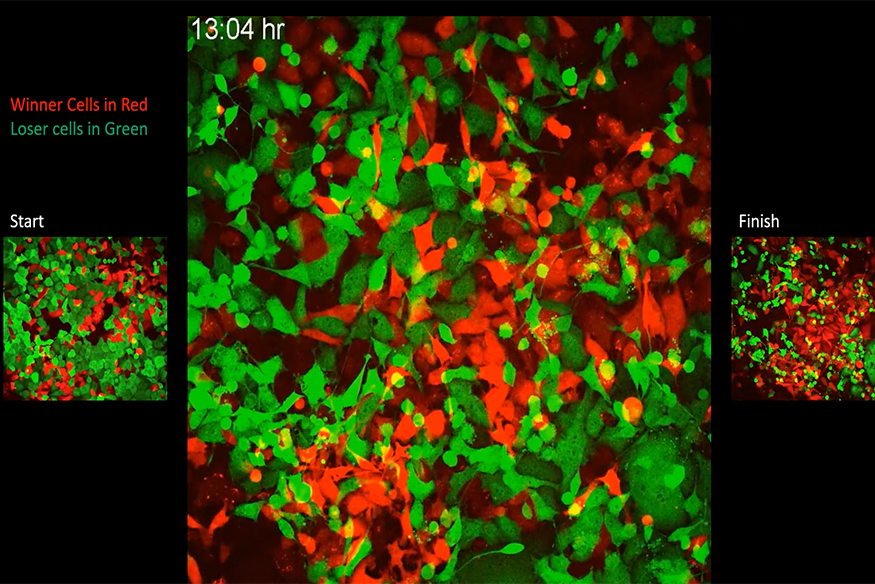 Red and green tumor cells