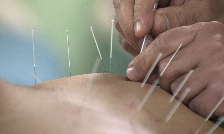 Best Acupuncture London