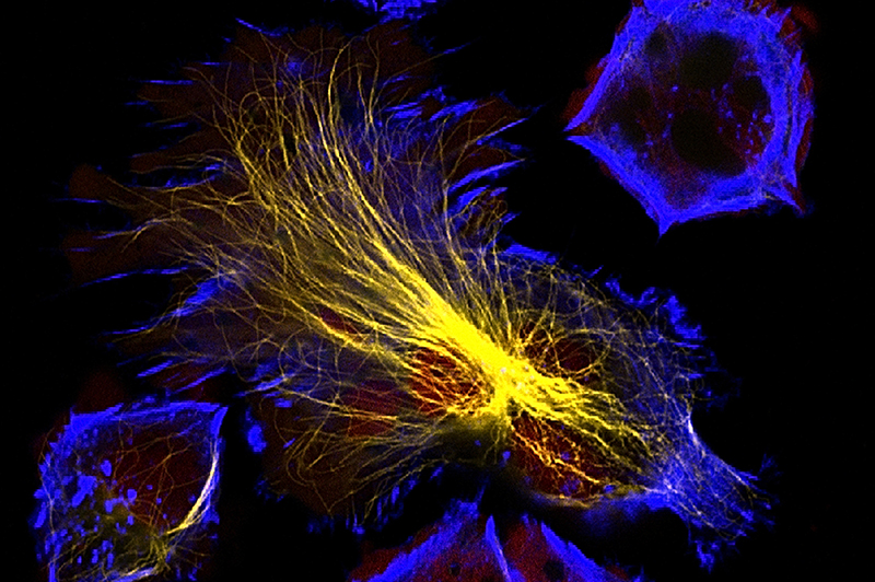 neuroblastoma cells