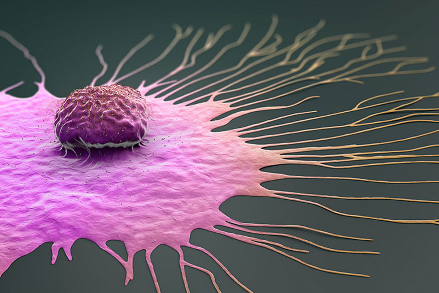 Breast cancer stock image